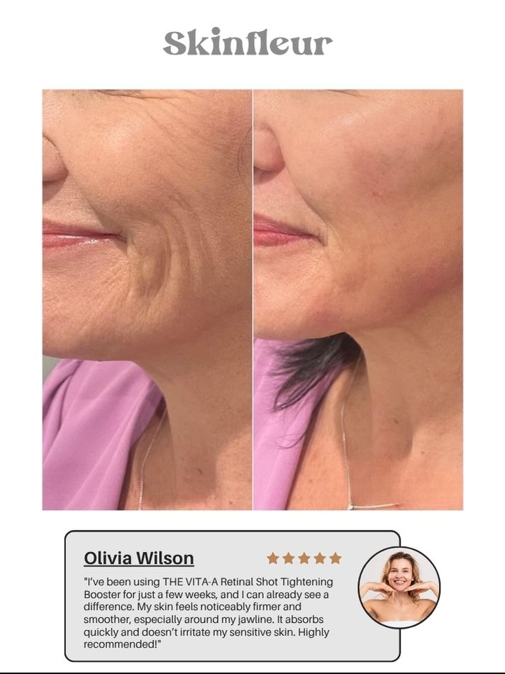 The Vita A Retinal Shot Tightening Booster (15ml/0.51oz) (Buy 1 Get 1 Free)