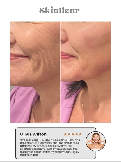 The Vita A Retinal Shot Tightening Booster (15ml/0.51oz) (Buy 1 Get 1 Free)