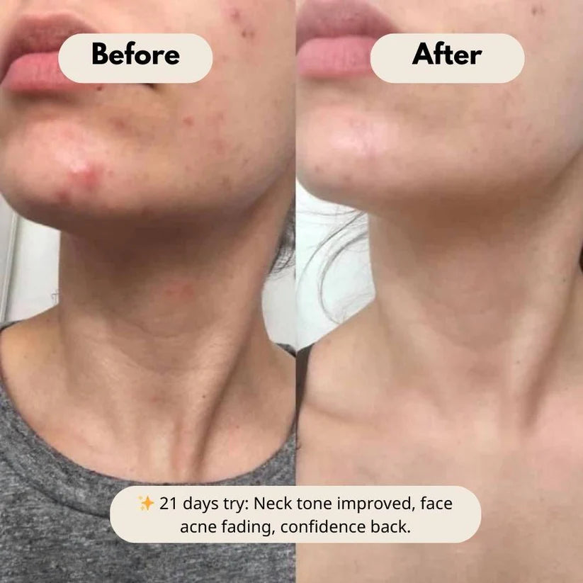 Peel Shot Glow Duo: White Rice Brightening & Black Rice Refining Ampoules (Buy 1 Get 1 Free)