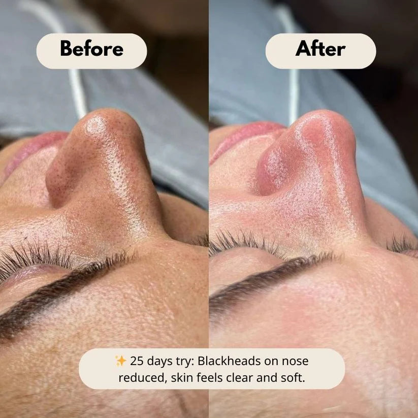 Peel Shot Glow Duo: White Rice Brightening & Black Rice Refining Ampoules (Buy 1 Get 1 Free)