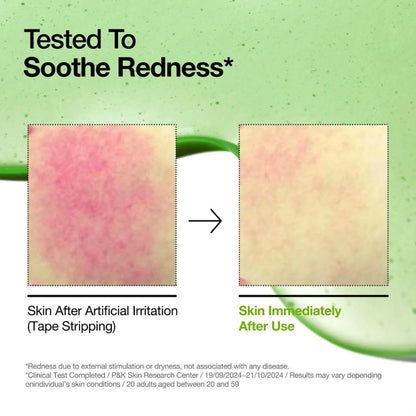 Azelaic Acid 10% + Hyaluron Redness Relief Serum (30ml /1.01 fl.oz)