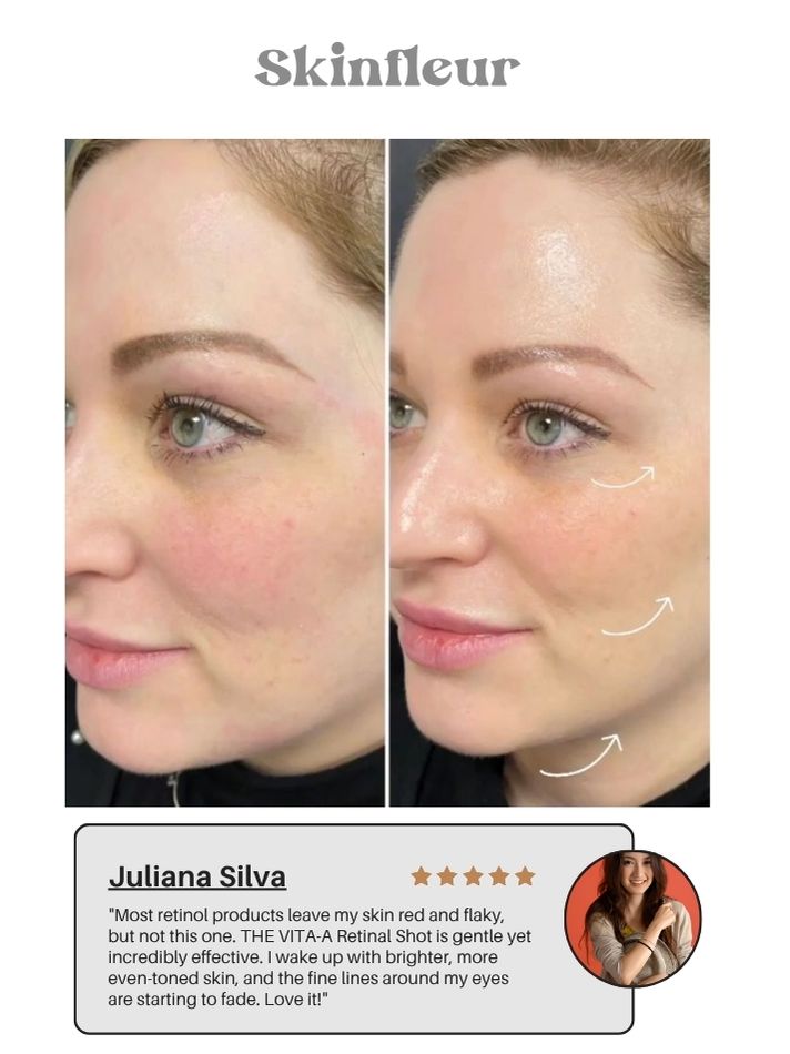 The Vita A Retinal Shot Tightening Booster (15ml/0.51oz) (Buy 1 Get 1 Free)