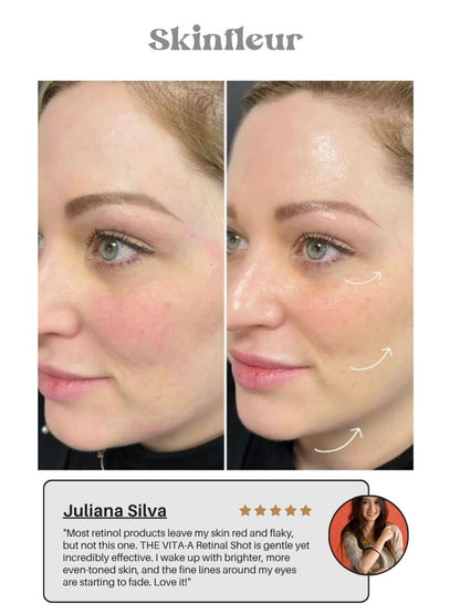 The Vita A Retinal Shot Tightening Booster (15ml/0.51oz) (Buy 1 Get 1 Free)