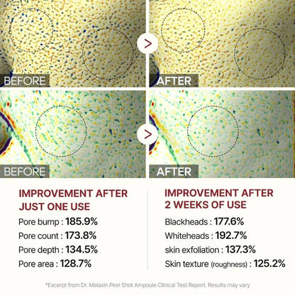 Peel Shot Glow Duo: White Rice Brightening & Black Rice Refining Ampoules (Buy 1 Get 1 Free)