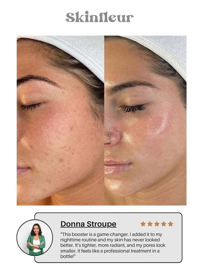 The Vita A Retinal Shot Tightening Booster (15ml/0.51oz) (Buy 1 Get 1 Free)